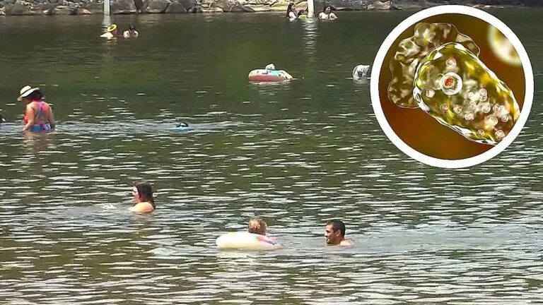 brain eating amoeba