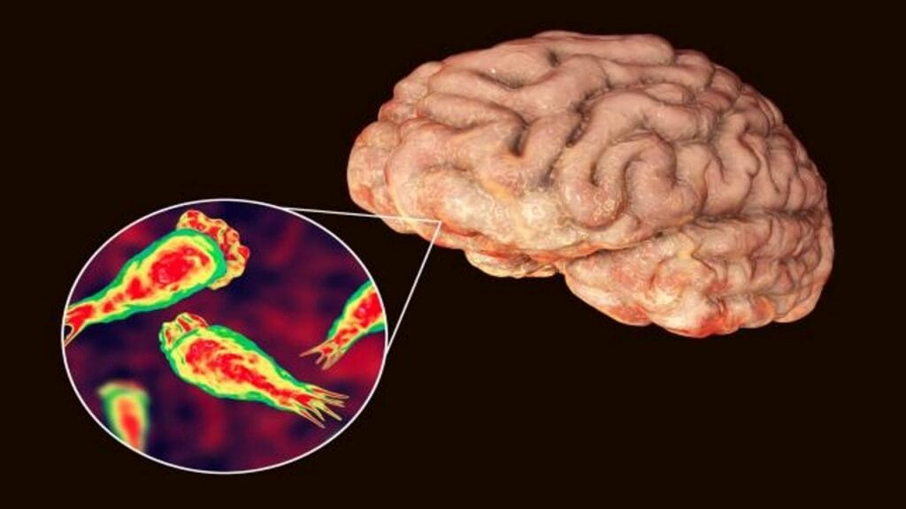 brain eating amoeba