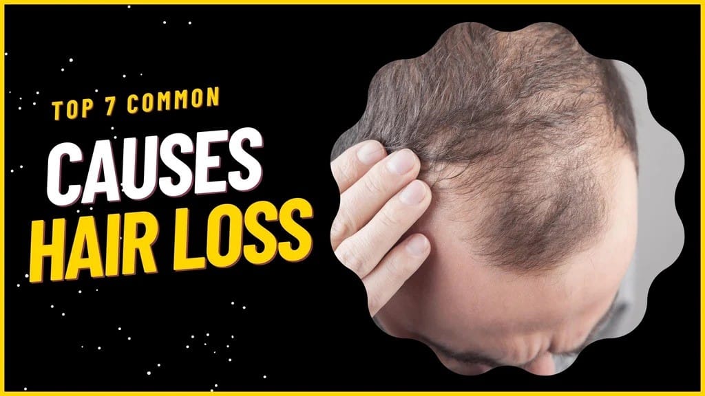 Hair loss