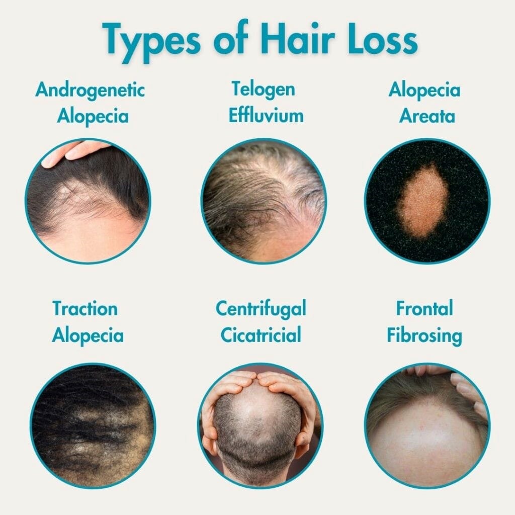 Hair loss